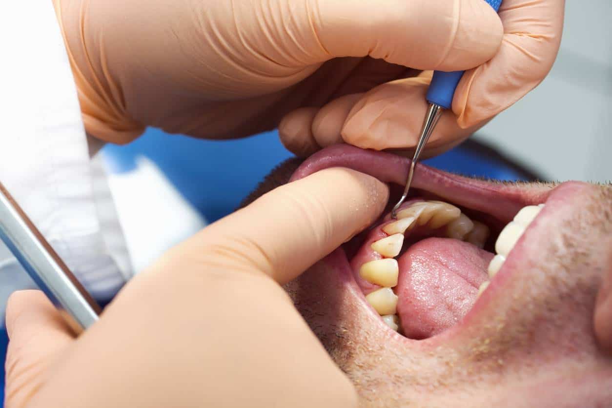 parodontologie clinique dentaire soins